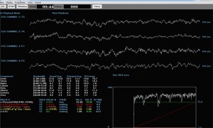 Readout of 4 channel Z-score Training